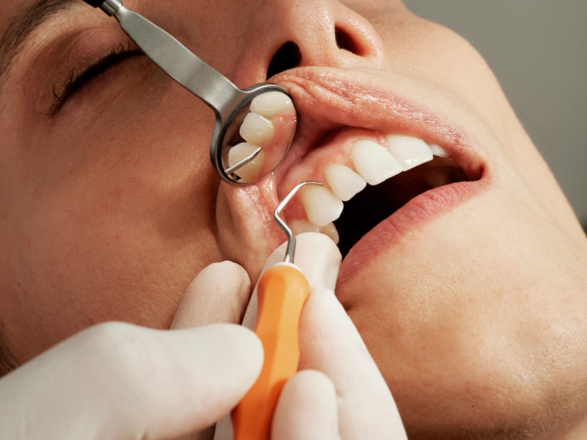 Does health insurance cover dental and vision